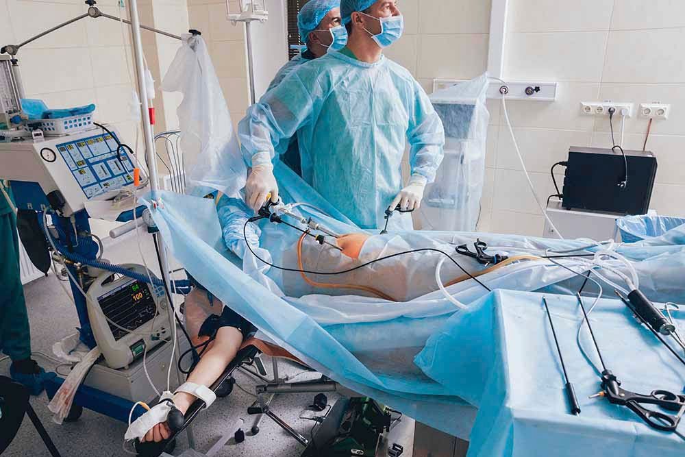 What to expect after laparoscopy